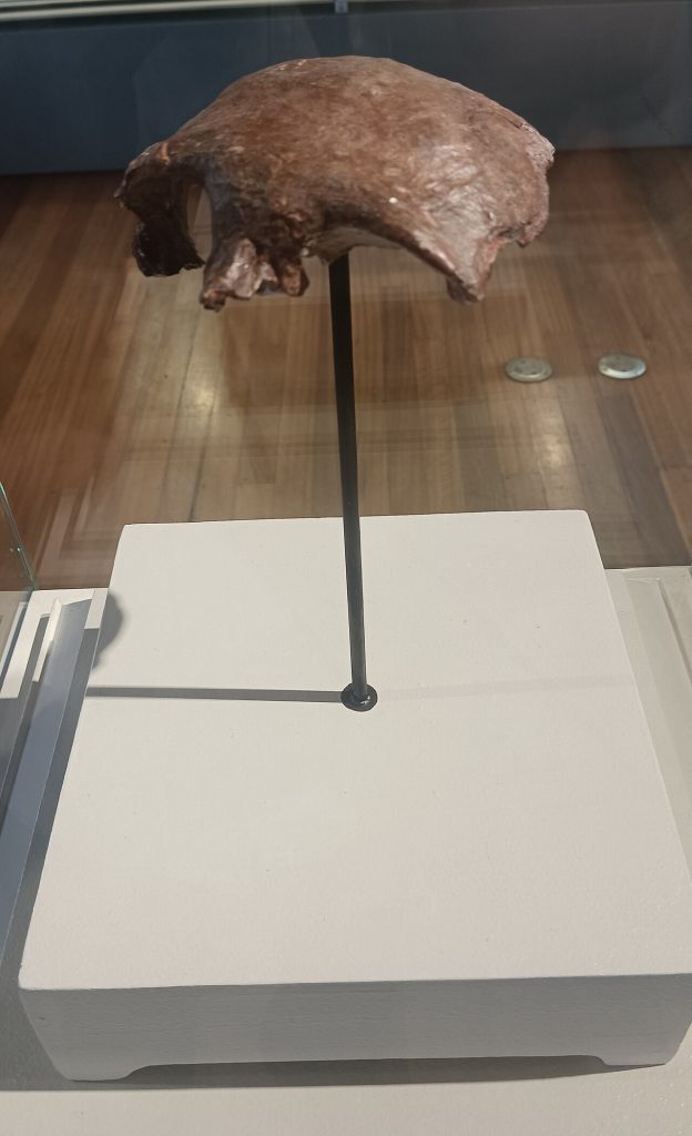 Why Evolution Left the Human Brain Brilliant but Vulnerable An ancient human skull cap fossil displayed in a museum